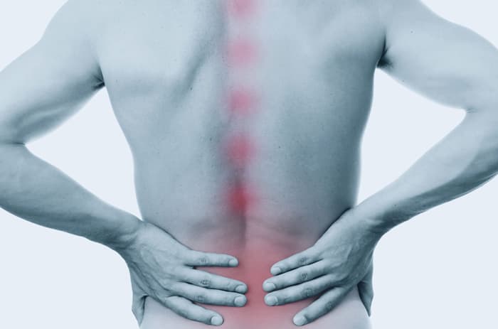 Ankylosing spondylitis